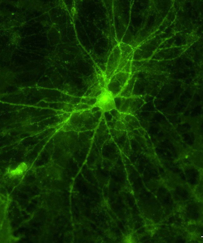 A neuron cell expressing fluorescent proteins introduced by gene therapy